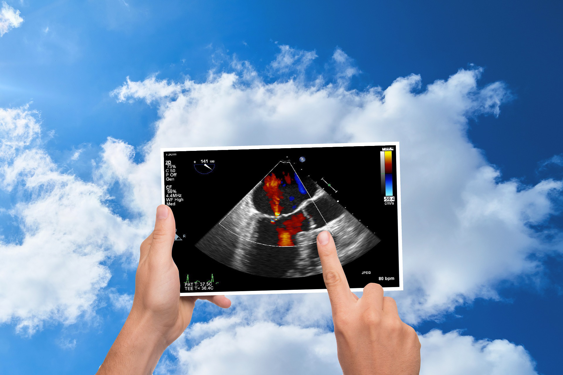 Cloud Cardiology PACS, clinical imaging workflow