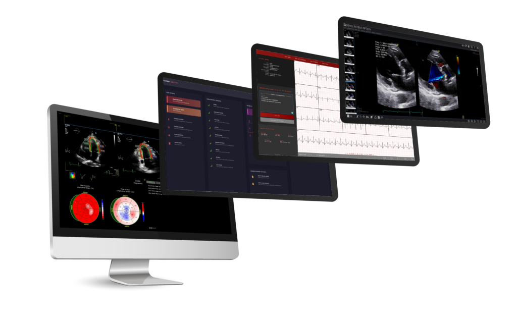 cardiology cloud PACS, echocardiography, ECG, Strain, Automated Intelligence