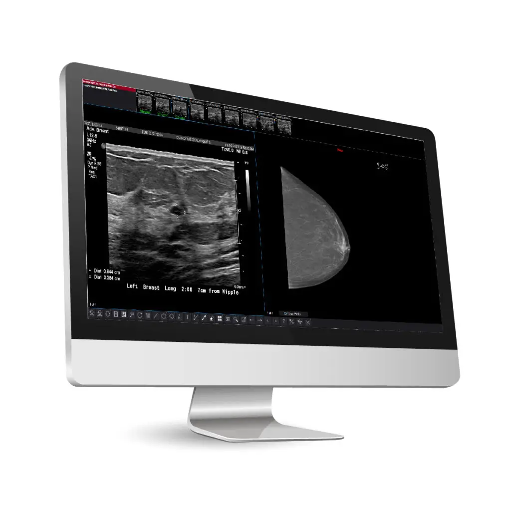 Womens Health PACS OBGYN