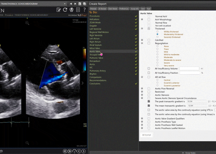 cardiology pacs system structured reporting side by side with echocardiogram