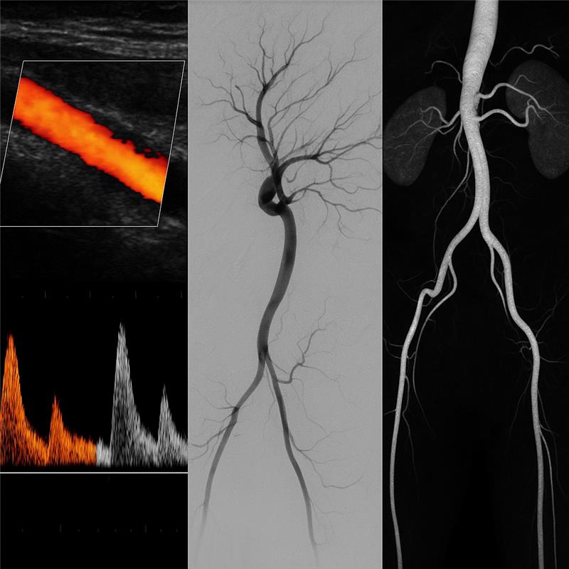 A doctor performing a vascular ultrasound scan on a patient’s leg