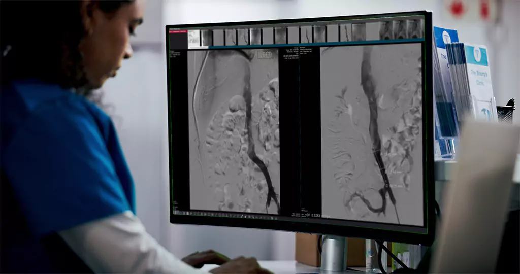 Medical professional analyzing vascular angiography images