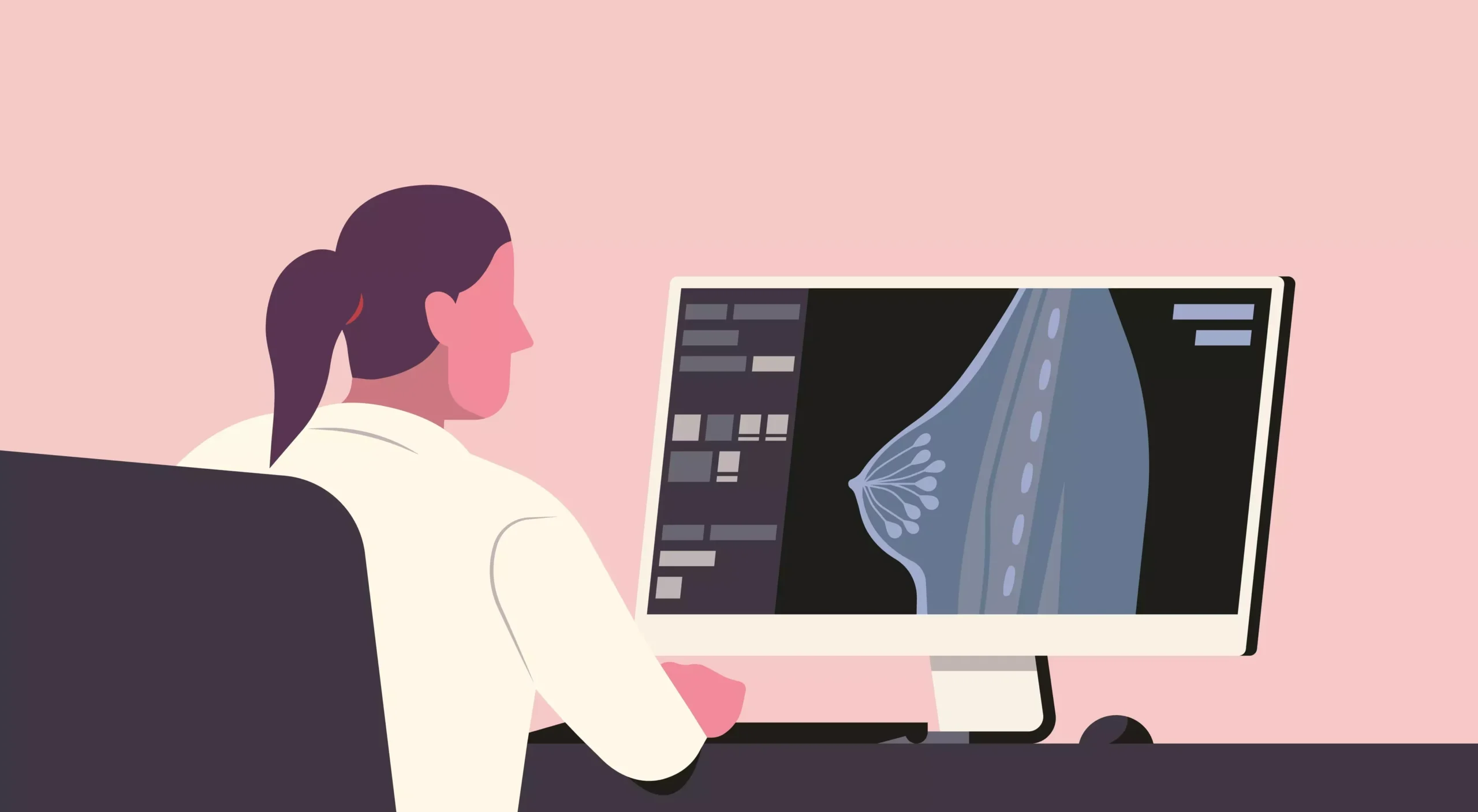 Medical monitor showing a mammogram scan