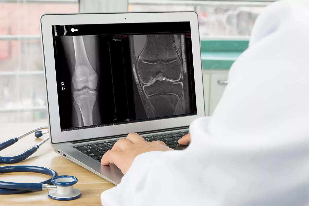 Radiologist reviewing knee X-ray and MRI on PACS system