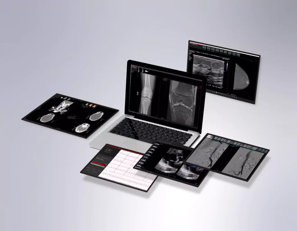 Multiple digital devices displaying medical images and reports