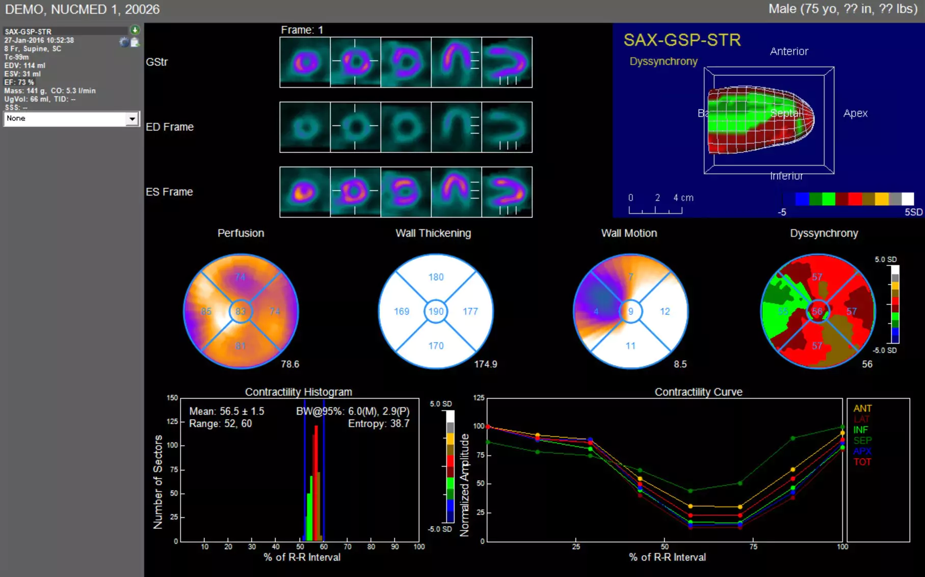 Nuclear Cardiology imaging results showing heart function and monitoring data