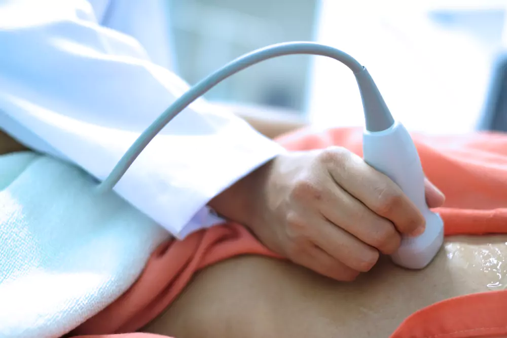 A doctor performing an ultrasound scan on a pregnant woman