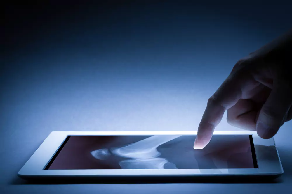 Radiology X-ray imaging on a tablet with digital interaction