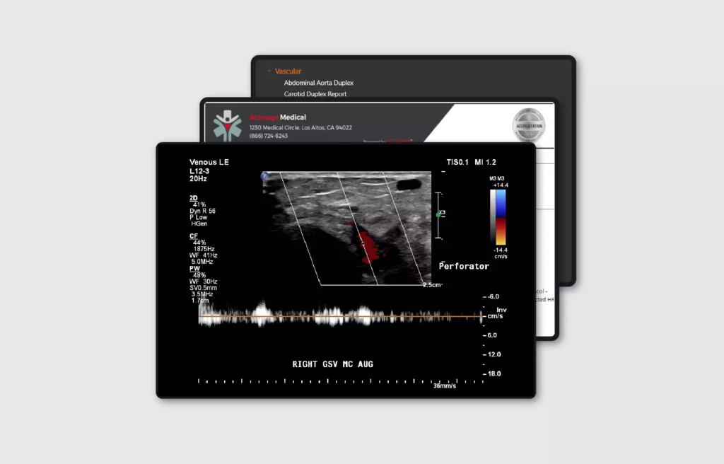 PICOM365 vascular reporting interface displaying an ultrasound scan