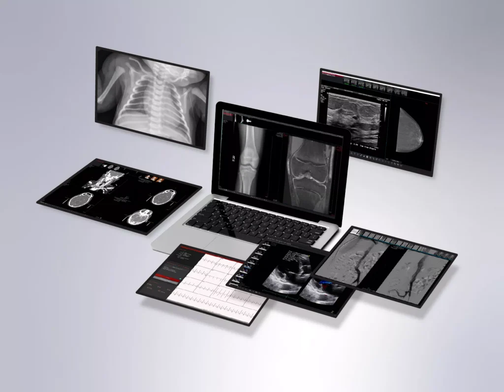 enterprise-workflows-laptop-with-mammo-echo-ecg-vascular-neurology-orthopedics-v4-03-68e7a4bf5a7c6