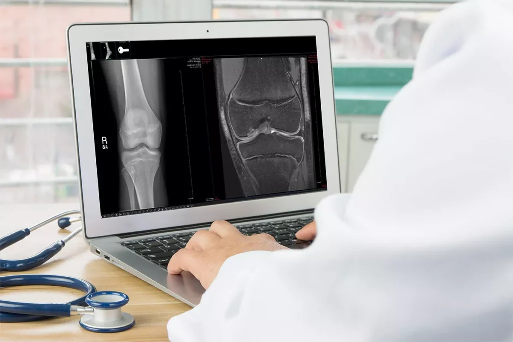 radiology-knee-mri-on-lapto