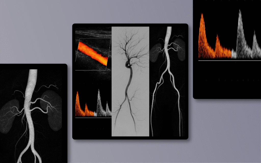 vascular imaging-02