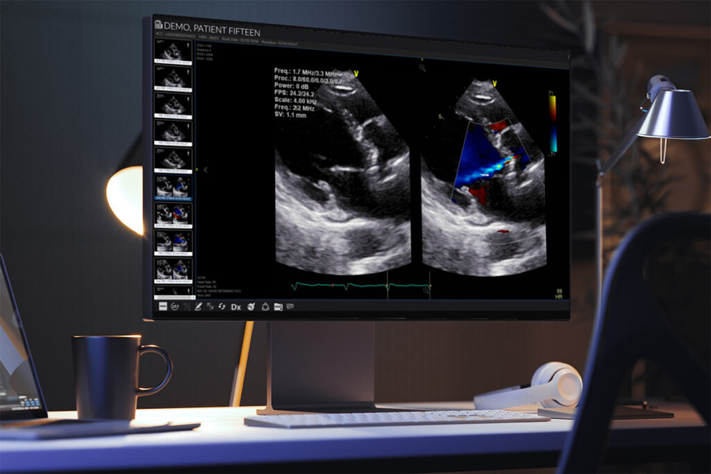 Telecardiology: Expanding Access to Cardiac Expertise